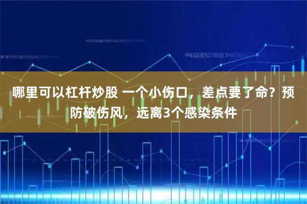 哪里可以杠杆炒股 一个小伤口,差点要了命?预防破伤风,远离3个感染条件